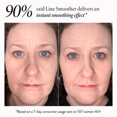 Line Smoother Full Face Kit (3PC)
